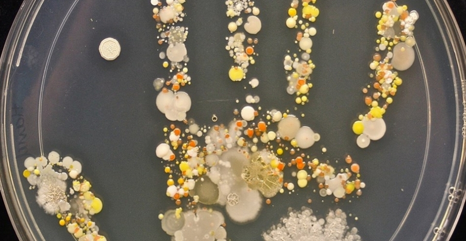 Микробы Под Ногтями Фото